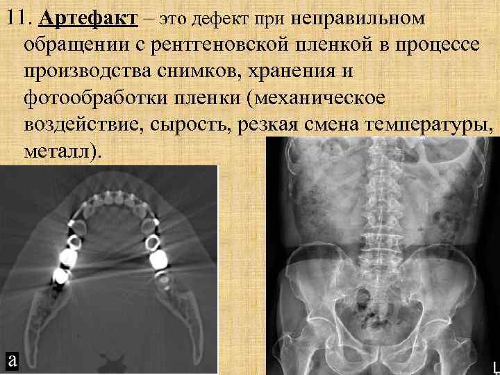 Введение в лучевую диагностику презентация