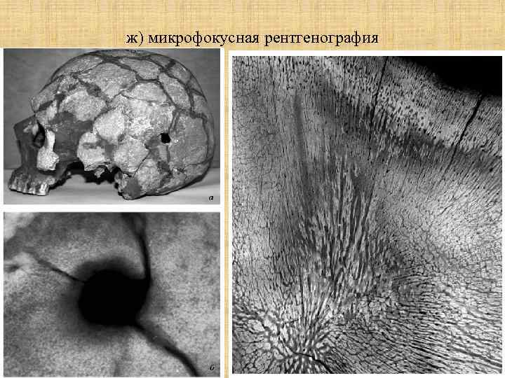ж) микрофокусная рентгенография 