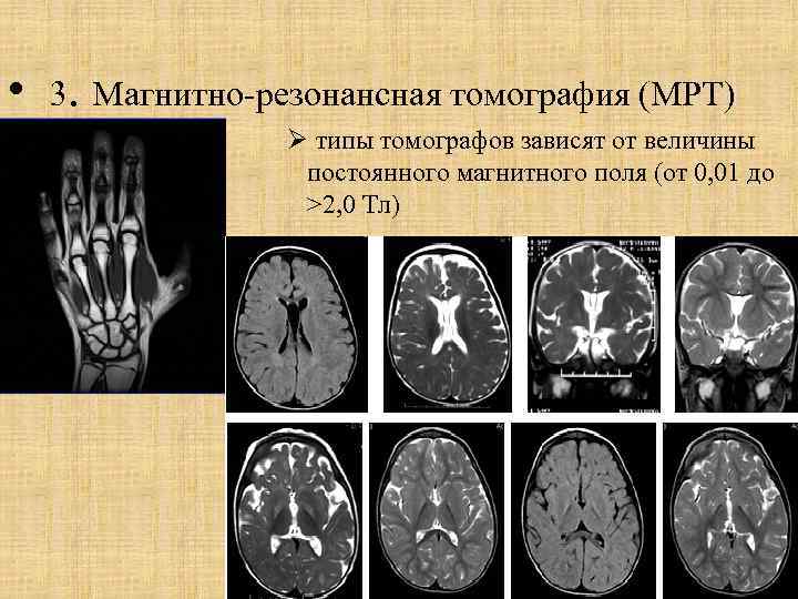  • 3. Магнитно-резонансная томография (МРТ) Ø типы томографов зависят от величины постоянного магнитного