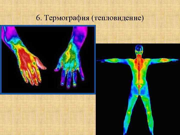 Медицинская термография презентация