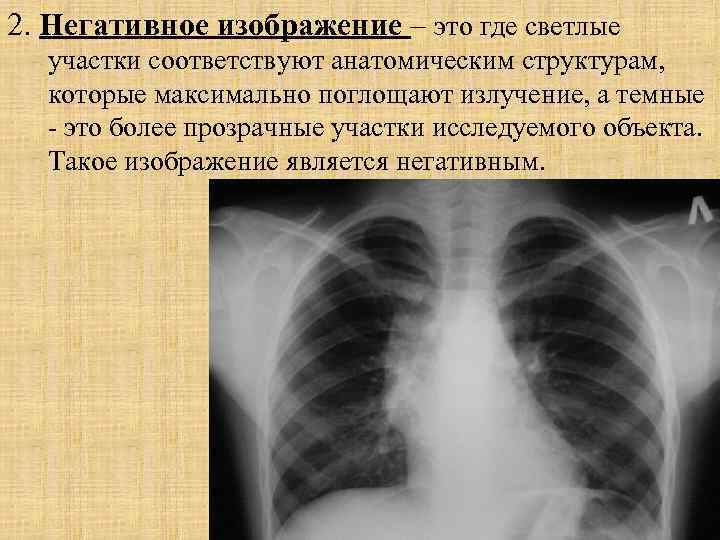 Рентгеновское изображение получают в результате неоднородного