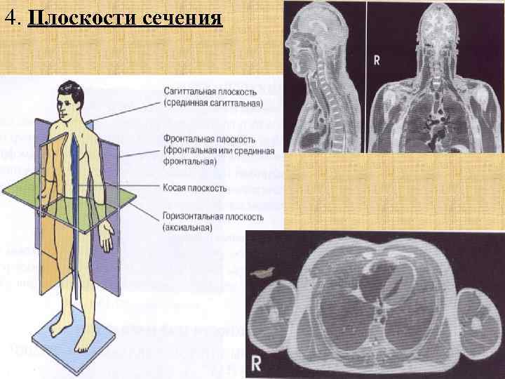 Введение в лучевую диагностику презентация