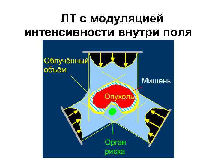 ЛТ с модуляцией интенсивности внутри поля 