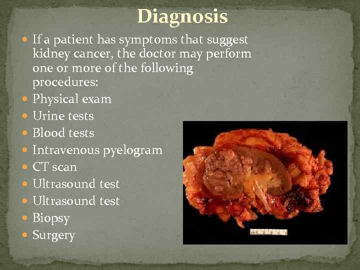 Diagnosis If a patient has symptoms that suggest kidney cancer, the doctor may perform