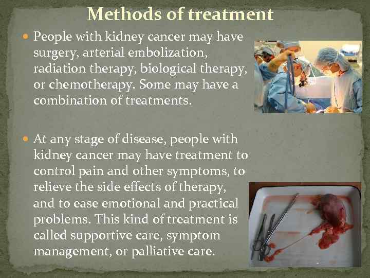 Methods of treatment People with kidney cancer may have surgery, arterial embolization, radiation therapy,