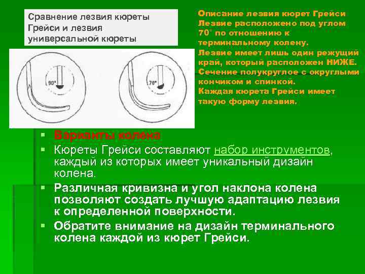 Сравнение лезвия кюреты Грейси и лезвия универсальной кюреты Описание лезвия кюрет Грейси Лезвие расположено