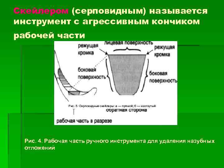 Скейлером (серповидным) называется инструмент с агрессивным кончиком рабочей части Рис. 5. Серповидные скейлеры: а