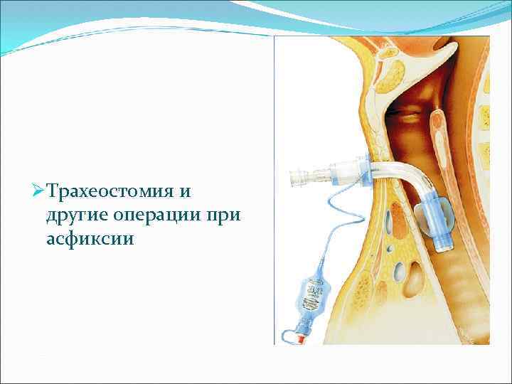 Топографическая анатомия и оперативная хирургия шеи презентация