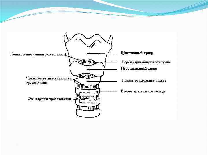 Топографическая анатомия и оперативная хирургия шеи презентация