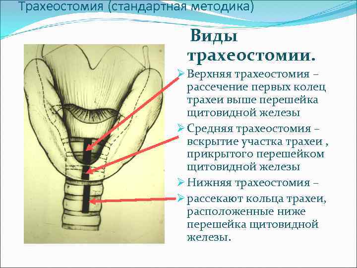 Топографическая анатомия и оперативная хирургия шеи презентация