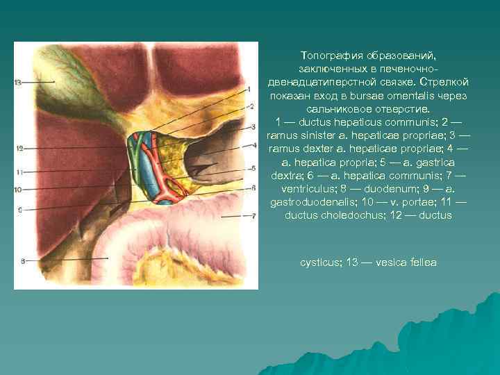 Топография образований, заключенных в печеночнодвенадцатиперстной связке. Стрелкой показан вход в bursae omentalis через сальниковое