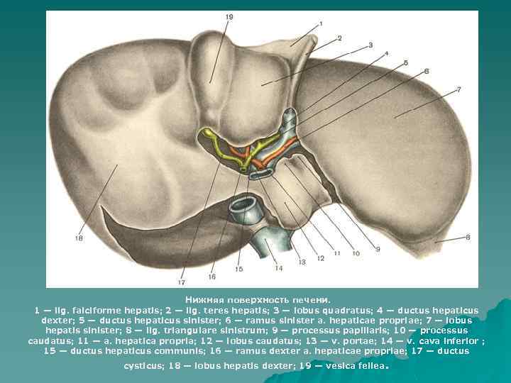 Нижняя поверхность печени. 1 — lig. falciforme hepatis; 2 — lig. teres hepatis; 3