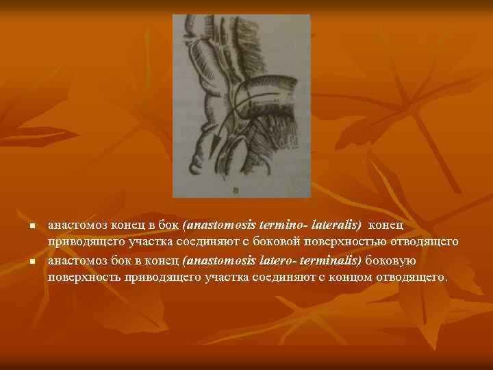 n n анастомоз конец в бок (anastomosis termino- lateralis) конец приводящего участка соединяют с