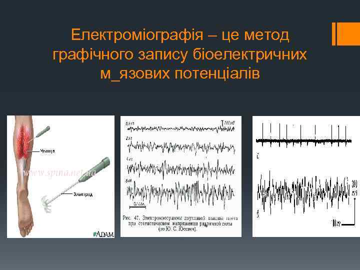 Електроміографія – це метод графічного запису біоелектричних м_язових потенціалів 