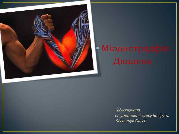  • Міодистродфія Дюшена Підготувала: студентка 4 курсу 3 а групи Дегтярук Ольга 