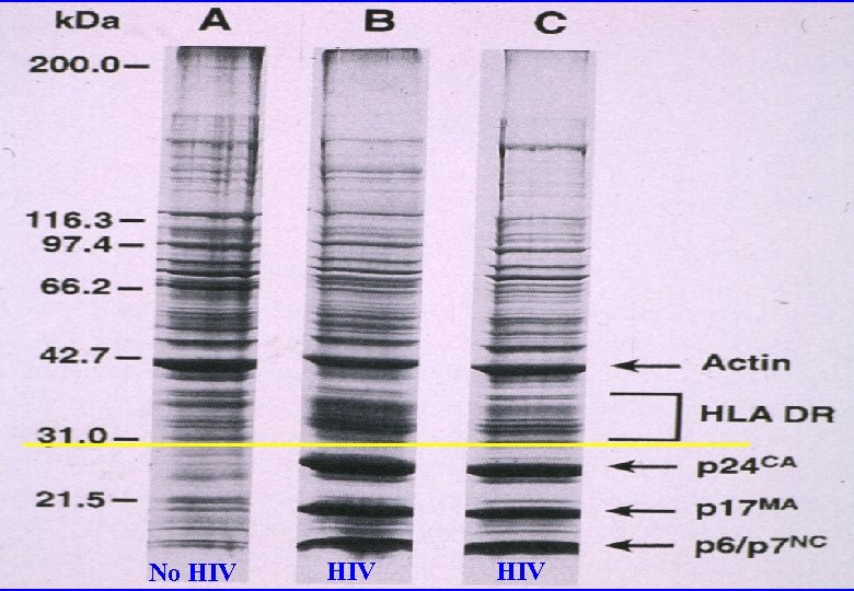 No HIV HIV 