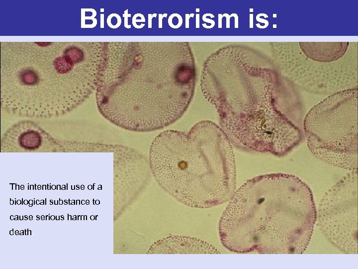 Bioterrorism is: The intentional use of a biological substance to cause serious harm or