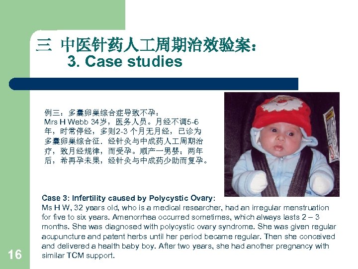 三 中医针药人 周期治效验案： 3. Case studies 例三：多囊卵巢综合症导致不孕： Mrs H Webb 34岁，医务人员。月经不调5 -6 年，时常停经，多则 2