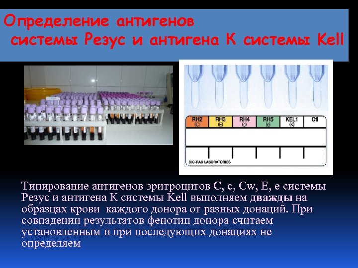 Определение антигенов системы Резус и антигена К системы Kell Типирование антигенов эритроцитов С, с,