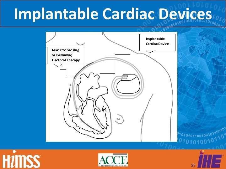 Implantable Cardiac Devices Implantable Cardiac Device Leads for Sensing or Delivering Electrical Therapy 37