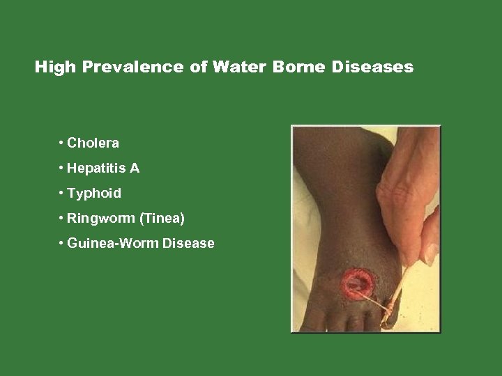 High Prevalence of Water Borne Diseases • Cholera • Hepatitis A • Typhoid •