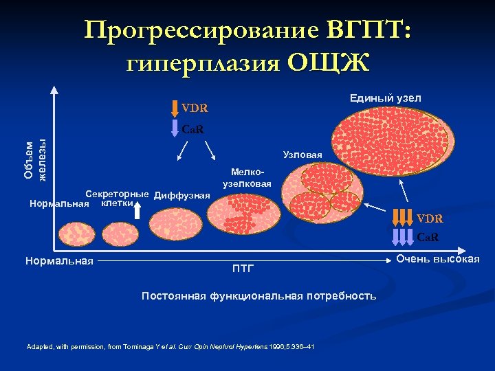 Прогрессирование ВГПТ: гиперплазия ОЩЖ Единый узел VDR Объем железы Ca. R Узловая Секреторные Диффузная