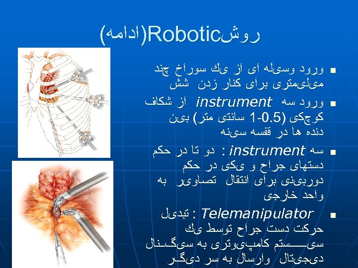  ﺭﻭﺵ )Robotic ﺍﺩﺍﻣﻪ( n n ﻭﺭﻭﺩ ﻭﺳیﻠﻪ ﺍی ﺍﺯ یﻚ ﺳﻮﺭﺍﺥ چﻨﺪ ﻣیﻠیﻤﺘﺮی