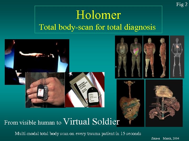 Fig 2 Holomer Total body-scan for total diagnosis From visible human to Virtual Soldier