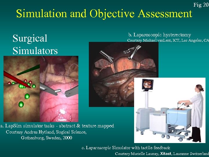 Simulation and Objective Assessment Fig 20 b. Laparoscopic hysterectomy Surgical Simulators Courtesy Michael van.