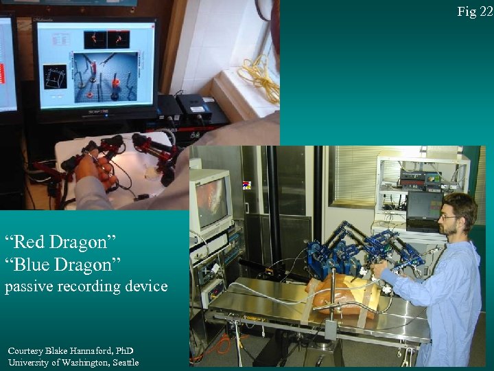 Fig 22 “Red Dragon” “Blue Dragon” passive recording device Courtesy Blake Hannaford, Ph. D