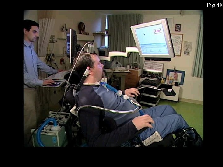 Fig 48 
