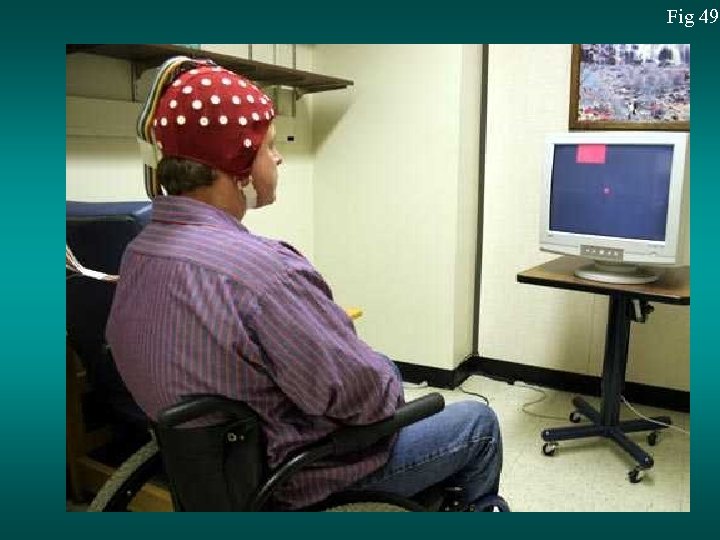 Fig 49 
