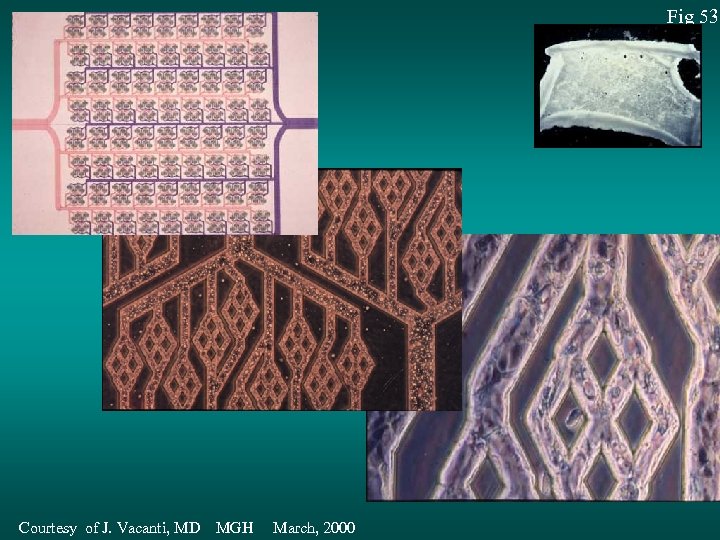 Fig 53 Courtesy of J. Vacanti, MD MGH March, 2000 