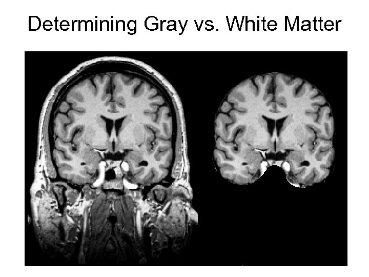 Determining Gray vs. White Matter 