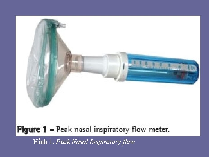 Hi nh 1. Peak Nasal Inspiratory flow 