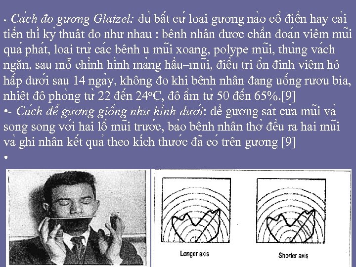 Ca ch đo gương Glatzel: du bâ t cư loa i gương na o