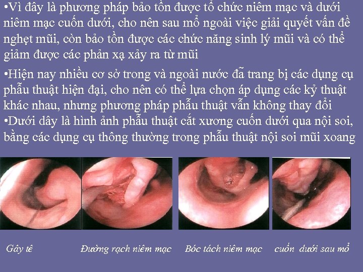  • Vì đây là phương pháp bảo tồn được tổ chức niêm mạc