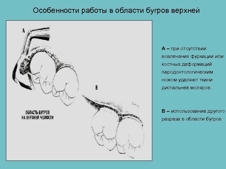 Подготовка полости рта к протезированию презентация