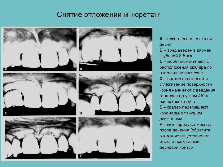 Стоматология пародонтальная карта