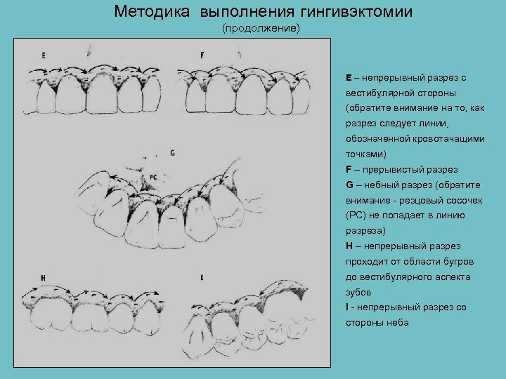 Общие принципы пародонтальной хирургии презентация