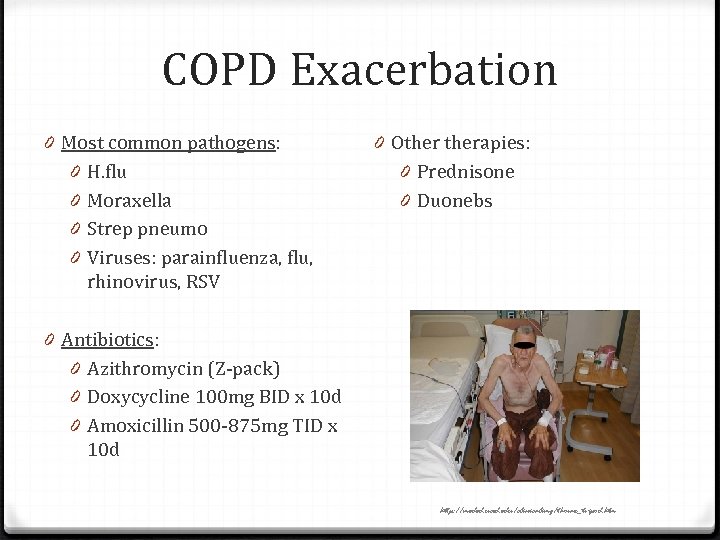 COPD Exacerbation 0 Most common pathogens: 0 H. flu 0 Moraxella 0 Strep pneumo