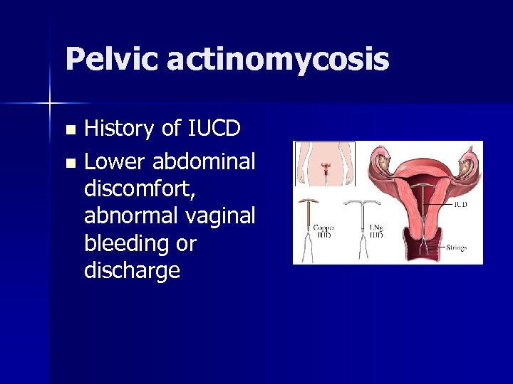 Pelvic actinomycosis History of IUCD n Lower abdominal discomfort, abnormal vaginal bleeding or discharge