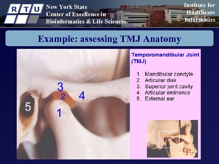 R T U New York State Center of Excellence in Bioinformatics & Life Sciences