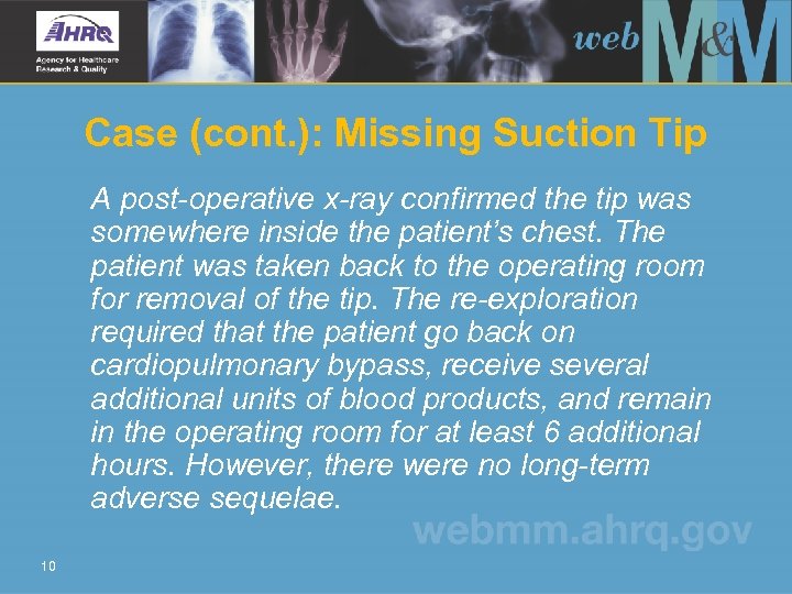 Case (cont. ): Missing Suction Tip A post-operative x-ray confirmed the tip was somewhere