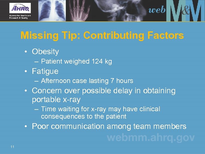 Missing Tip: Contributing Factors • Obesity – Patient weighed 124 kg • Fatigue –