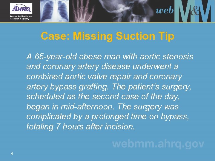 Case: Missing Suction Tip A 65 -year-old obese man with aortic stenosis and coronary