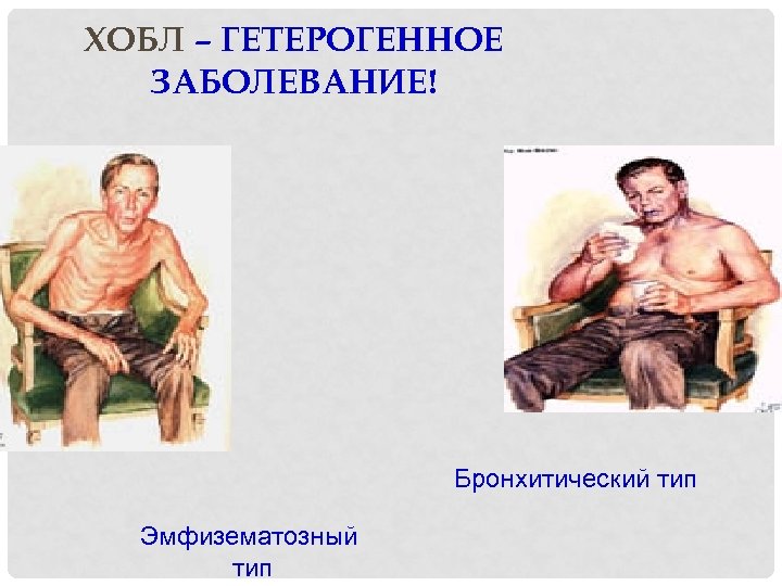 ХОБЛ – ГЕТЕРОГЕННОЕ ЗАБОЛЕВАНИЕ! Бронхитический тип Эмфизематозный тип 