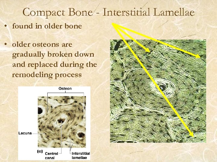 Compact Bone - Interstitial Lamellae • found in older bone • older osteons are