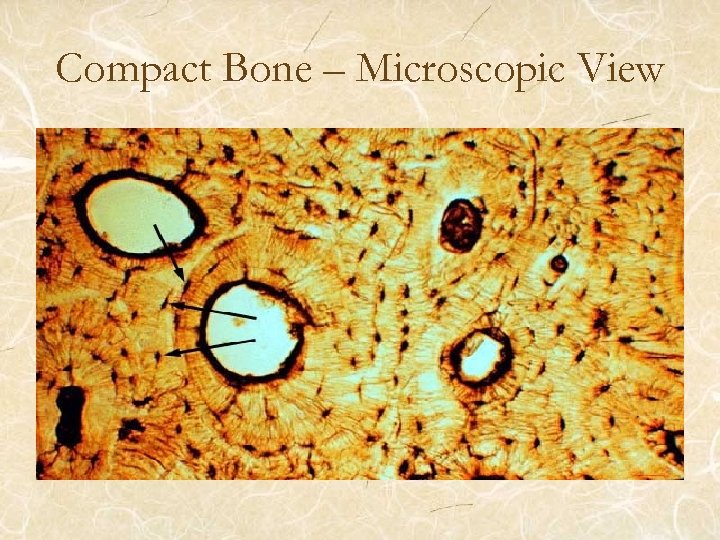 Compact Bone – Microscopic View 
