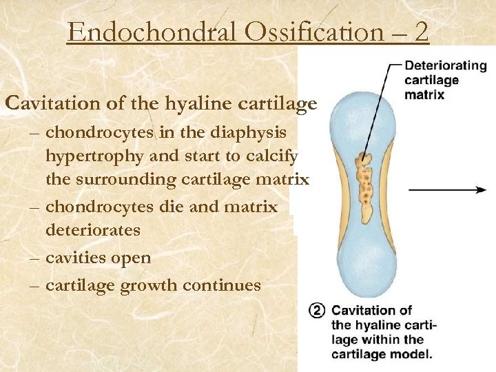 Endochondral Ossification – 2 Cavitation of the hyaline cartilage – chondrocytes in the diaphysis
